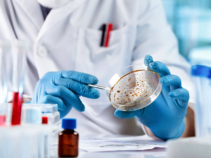 Microbiologist wearing protective blue gloves examining mold in petri dish in a laboratory